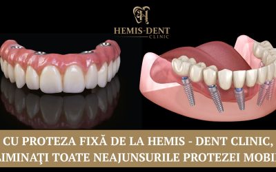 Cu proteza fixă de la Hemis – Dent Clinic, eliminaţi toate neajunsurile protezei mobile